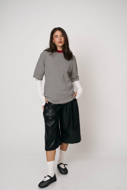 מכנסי ברמודה לוקה - שחור